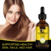Turkish Black Seed Oil Nigella Sativa Exceptionally Thymoquinone With Antioxidants Healthy Joints Hair Skin Strengthen Immunity - Image 3